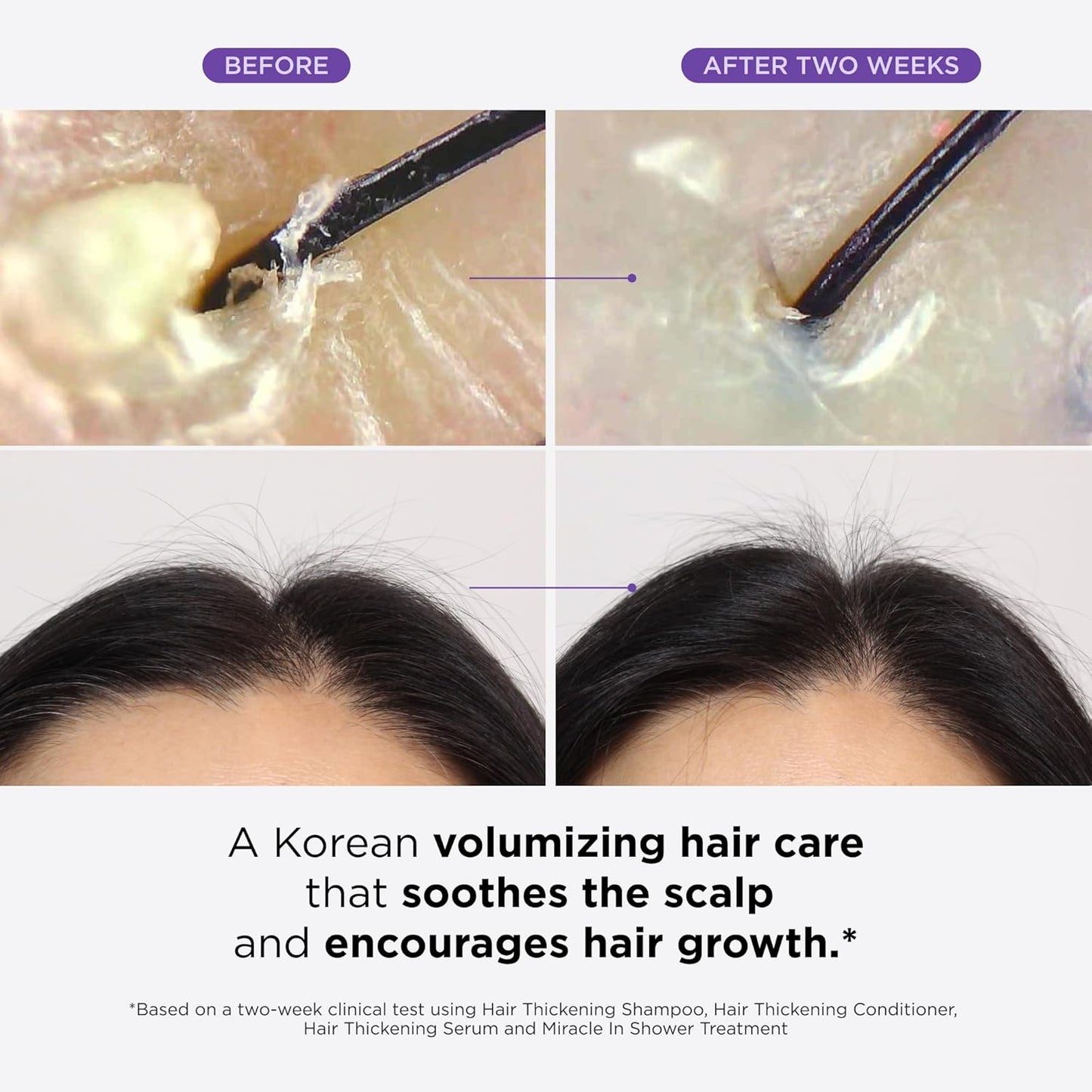 Thickening Hair Essentials Set™